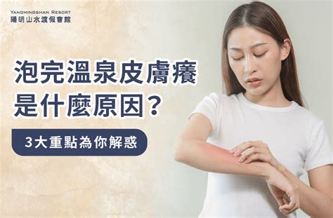 撓癢|科普：人為什麼會發癢，撓癢為什麼會讓人感到舒服？